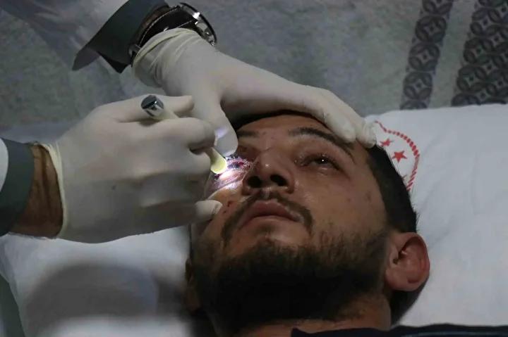 Havai Fişek Patlaması Sonucunda Göz Yaralanması Yapan Baba, Gözdeki Durumu Anlatıyor