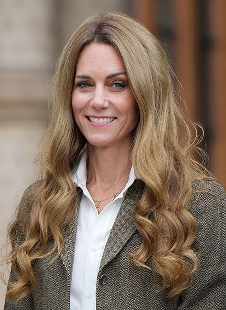Kate Middleton’un Sağlık Mücadelesi ve Topluma Yansıyan Yüzü