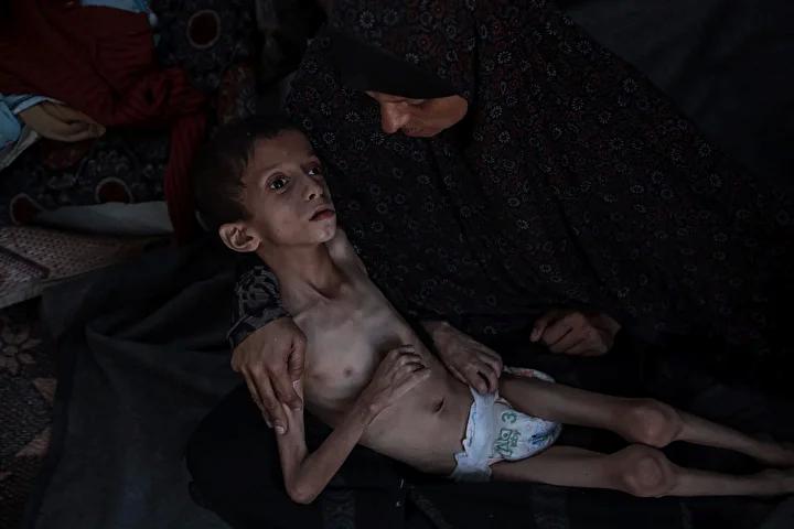 Zihinsel Engelli Navz'in Yaşadığı İnsanî Kriz ve Acil Destek İhtiyacı
