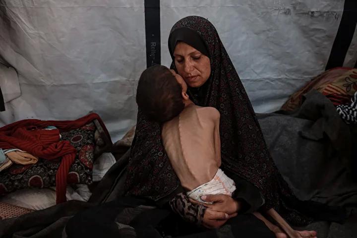 Zihinsel Engelli Navz'in Yaşadığı İnsanî Kriz ve Acil Destek İhtiyacı