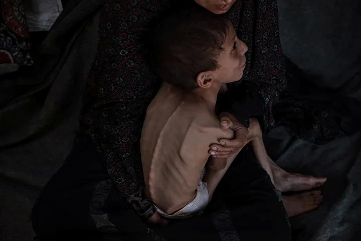 Zihinsel Engelli Navz'in Yaşadığı İnsanî Kriz ve Acil Destek İhtiyacı