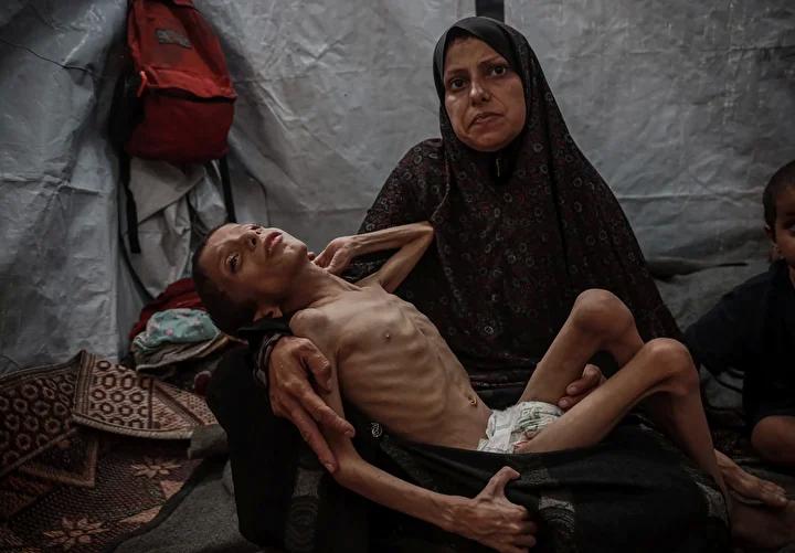 Zihinsel Engelli Navz'in Yaşadığı İnsanî Kriz ve Acil Destek İhtiyacı