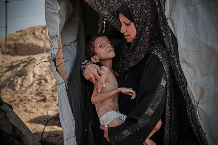 Zihinsel Engelli Navz'in Yaşadığı İnsanî Kriz ve Acil Destek İhtiyacı