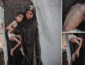 Zihinsel Engelli Navz’in Yaşadığı İnsanî Kriz ve Acil Destek İhtiyacı