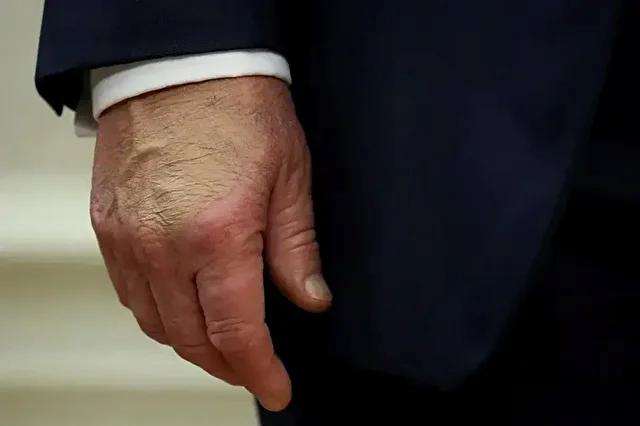 ABD Başkanı Trump’ın Sağlık Durumu Güncel ve Detaylı Değerlendirildi
