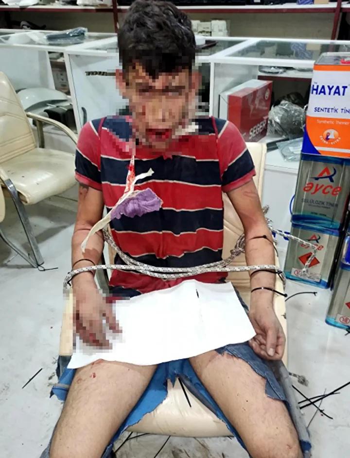Antalya’da İşkence Olayı Davası: Vedat Kurt’un Şikayeti ve Mahkeme Süreci