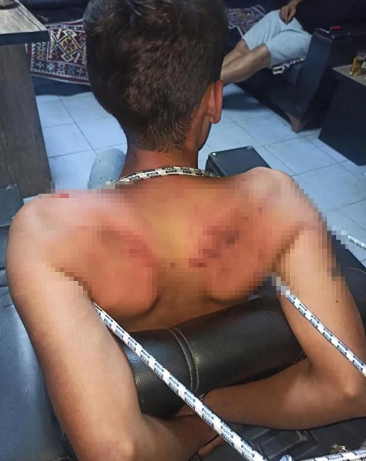 Antalya’da İşkence Olayı Davası: Vedat Kurt’un Şikayeti ve Mahkeme Süreci