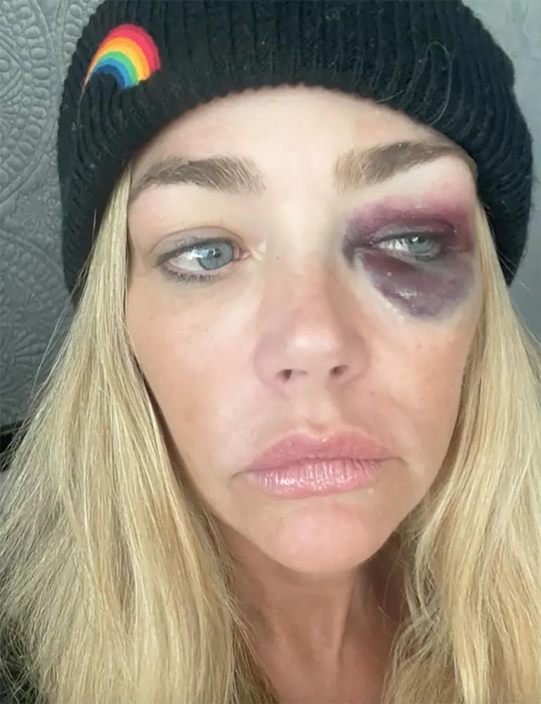 Denise Richards'in Mahkemedeki Çocuklar Üzerindeki Şiddet İddiaları ve Eski Eşle İlgili Detaylar