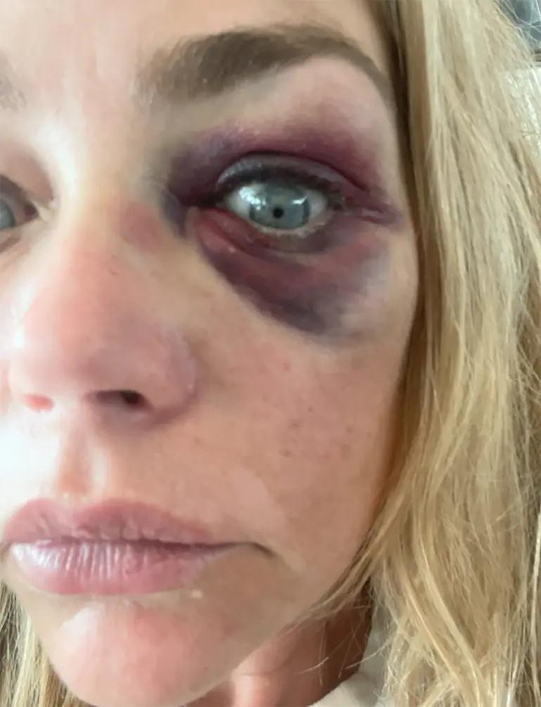 Denise Richards'tan Eski Eşi Aaron Phypers'a Şiddet Suçlaması Dalgası