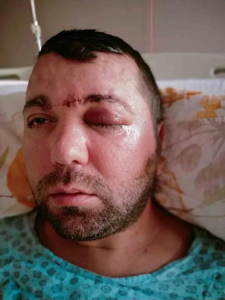 Diş Tedavisi Sırasında Yaşanan Talihsiz Olay ve Hukuki Mücadele 1 Yaşananlar ve Sonrası