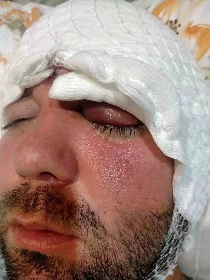 Diş Tedavisi Sırasında Yaşanan Talihsiz Olay ve Hukuki Mücadele 3 Yasal ve Mesleki Tepkiler