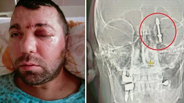 Diş Tedavisi Sırasında Yaşanan Talihsiz Olay ve Hukuki Mücadele 4 Yasal ve Mesleki Tepkiler