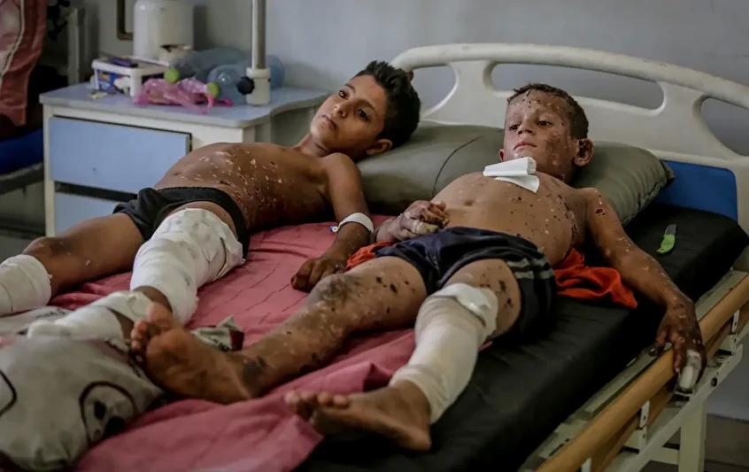 Gazze'de Çocuklara Yönelik Patlama Olayı ve Yaralanmalar