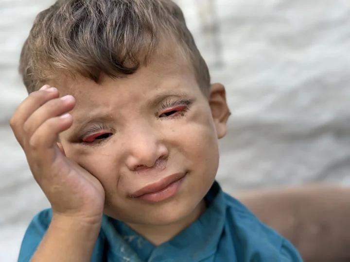 Gazze'deki Zor Hayat: Ramez’in Görünmeyen Mücadelesi