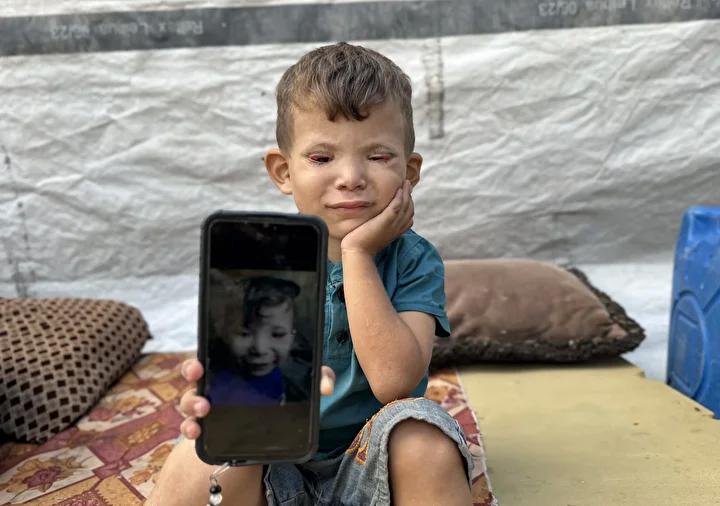 Gazze'deki Zor Hayat: Ramez’in Görünmeyen Mücadelesi