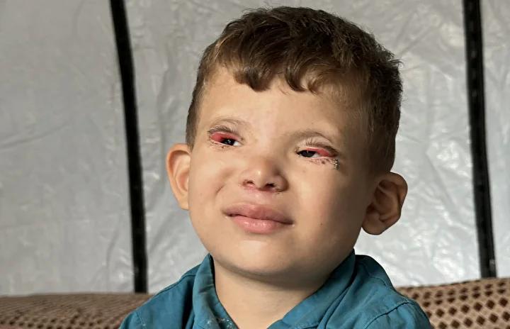 Gazze'deki Zor Hayat: Ramez’in Görünmeyen Mücadelesi