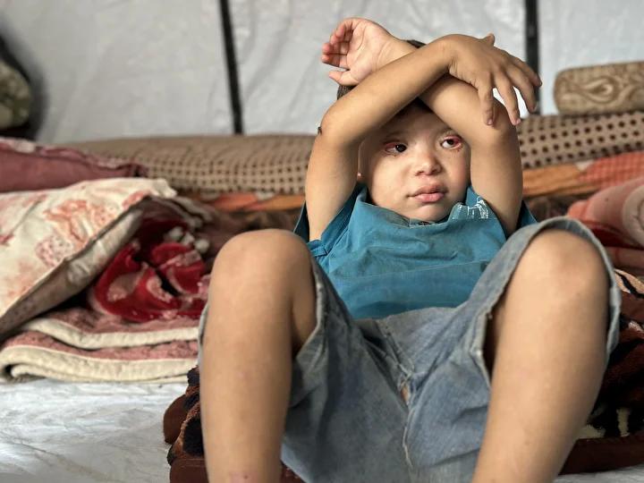 Gazze'deki Zor Hayat: Ramez’in Görünmeyen Mücadelesi