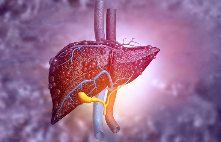 Günlük Gazlı İçecek Tüketiminin Karaciğer Sağlığına Etkileri ve Yeni Bulgular