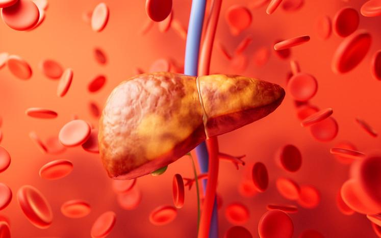 Günlük Gazlı İçecek Tüketiminin Karaciğer Sağlığına Etkileri ve Yeni Bulgular