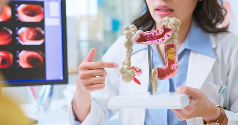 Mikroplastiklerin İnsan Bağırsak Sağlığı Üzerindeki Kısıtlı Ama Potansiyel Etkileri