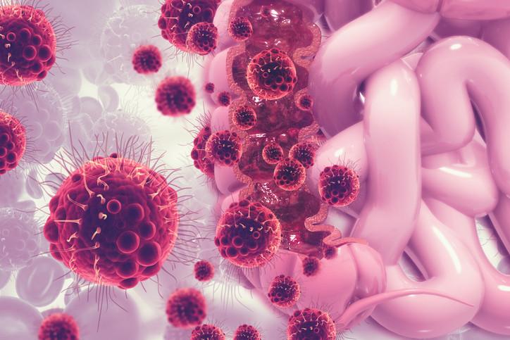 Mikroplastiklerin İnsan Bağırsak Sağlığı Üzerindeki Kısıtlı Ama Potansiyel Etkileri