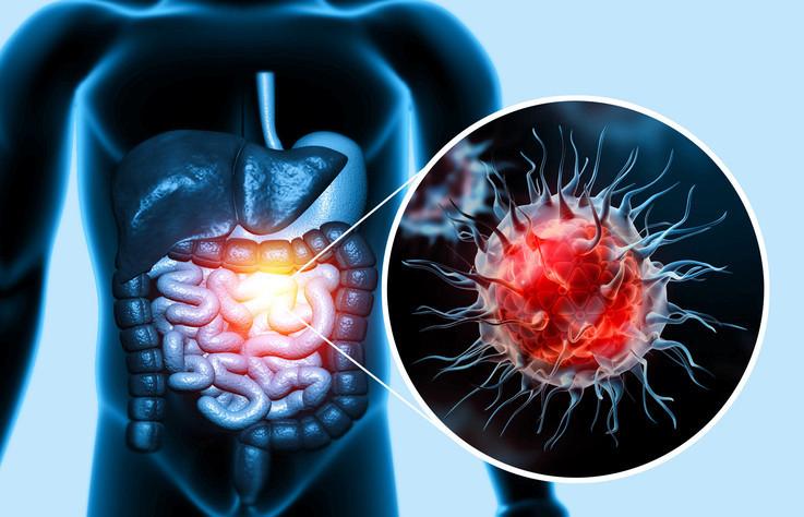 Mikroplastiklerin İnsan Bağırsak Sağlığı Üzerindeki Kısıtlı Ama Potansiyel Etkileri