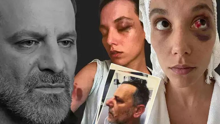 Ozan Güven Kararını Onaylattı: Hapis Cezası Kesildi 2 Olayın Geçmişi ve Yasal Süreç