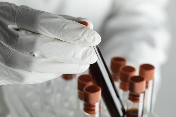 Paratiroid Adenomu: Gizli Bir Tehlike ve Erken Tanı Yöntemleri