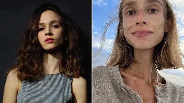 Polonya'nın Sosyal Medya Fenomeni Karolina Krzyzak Hayatını Kaybetti