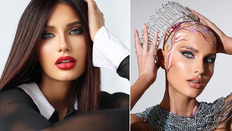 Saçsızlığıyla Göz kamaştıran Miss Nevada’nın İlham Veren Hikayesi