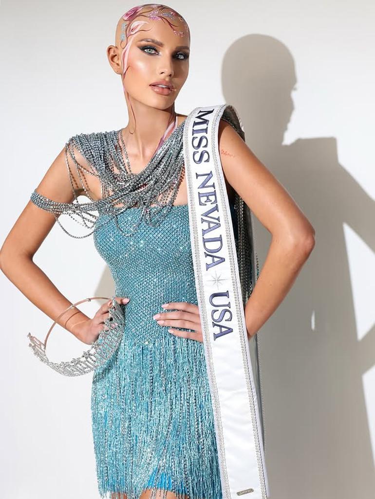 Saçsızlığıyla Göz kamaştıran Miss Nevada’nın İlham Veren Hikayesi