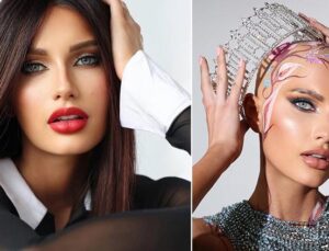 Saçsızlığıyla Göz kamaştıran Miss Nevada’nın İlham Veren Hikayesi