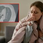 Solunum Yolu Enfeksiyonlarindaki Artis ve Guncel Varyantler Hakkinda Detaylar