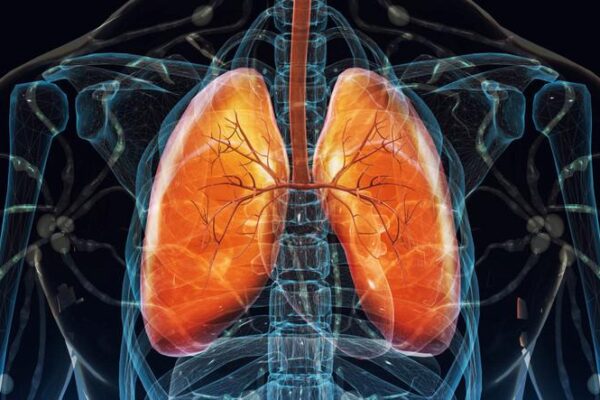 Akciger Kanseri Riskleri ve Erken Tani Yontemleri