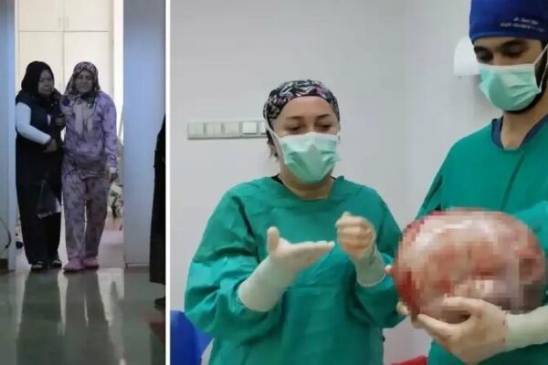 Amasya’da 8,5 Kiloluk Kitle Ameliyatı ile Hayata Tutundu