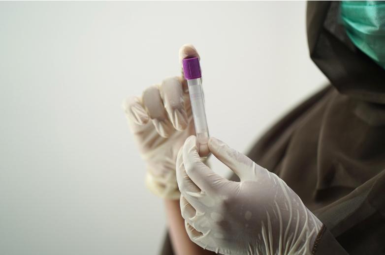 Bolu'da Deli Dana Tespitinin Ardından: Hastalık Hakkında Bilmeniz Gerekenler