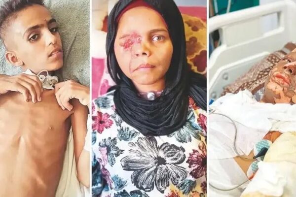 Gazze’de Çocukların Bedel Ödedikleri Savaşın İzleri ve İçerikleri