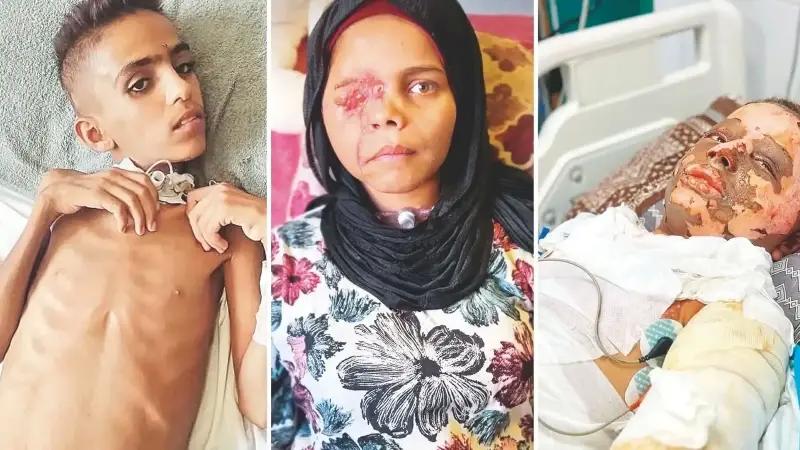 Gazze’de Çocukların Bedel Ödedikleri Savaşın İzleri ve İçerikleri