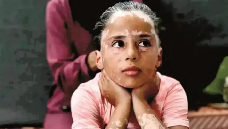 Gazzeli Çocukların Travmatik Günleri ve Psikolojik Yıkım