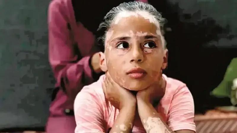 Gazzeli Çocukların Travmatik Günleri ve Psikolojik Yıkım