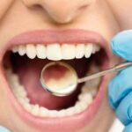 Ingilterede Yenilikci Dis Mine Onarim Teknolojisi Gelistirildi