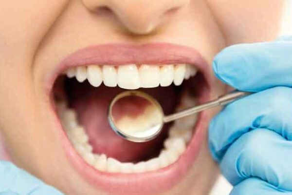 İngiltere’de Yenilikçi Diş Mine Onarım Teknolojisi Geliştirildi