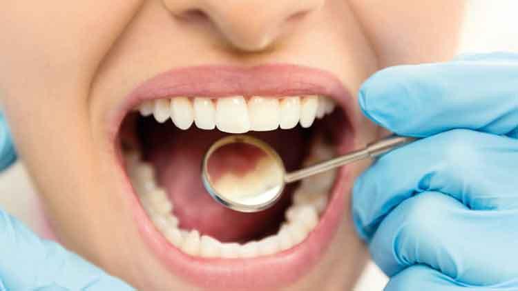 Ingilterede Yenilikci Dis Mine Onarim Teknolojisi Gelistirildi