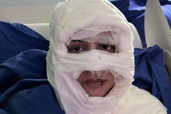 Kadıköy’de Korkunç Saldırı: 33 Yaşındaki Gözde Yılmaz Ateşe Verildi