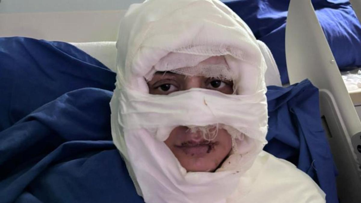 Kadıköy’de Korkunç Saldırı: 33 Yaşındaki Gözde Yılmaz Ateşe Verildi