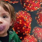 Kizamik Vakalarinda Artis ve Asilamanin Onemi Guncel Durumlar ve Bilinmesi Gerekenler