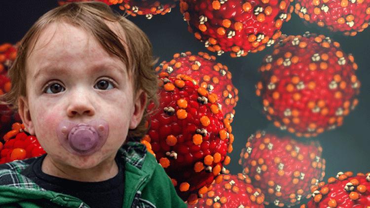 Kızamık Vakalarında Artış ve Aşılamanın Önemi: Güncel Durumlar ve Bilinmesi Gerekenler