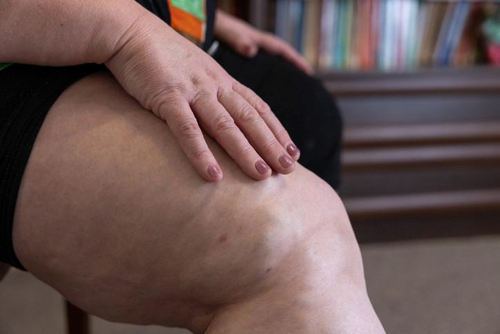 Yanlış Bilinenler ve Doğru Yaklaşımlar