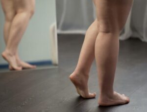 Lipödem ve Sağlıklı Yaşam İçin Yeni Yaklaşımlar