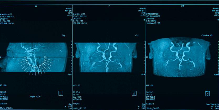 Yuz Norolojisi ve Tedavi Surecinde Yasananlar McInerny8217nin Hikayesi Yuz Norolojisi ve Tedavi Surecinde Yasananlar McInernynin Hikayesi